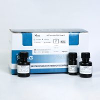 MDA